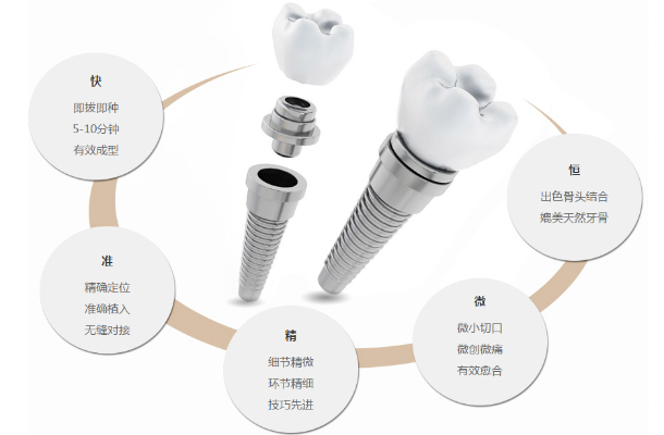 郑州种植牙系统有哪些
